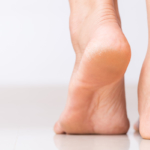 Sucha i szorstka skóra stóp to uciążliwy problem. Jak pielęgnować stopy latem i mroźną zimą, aby były gładkie? Po jakie kremy do stóp sięgać?